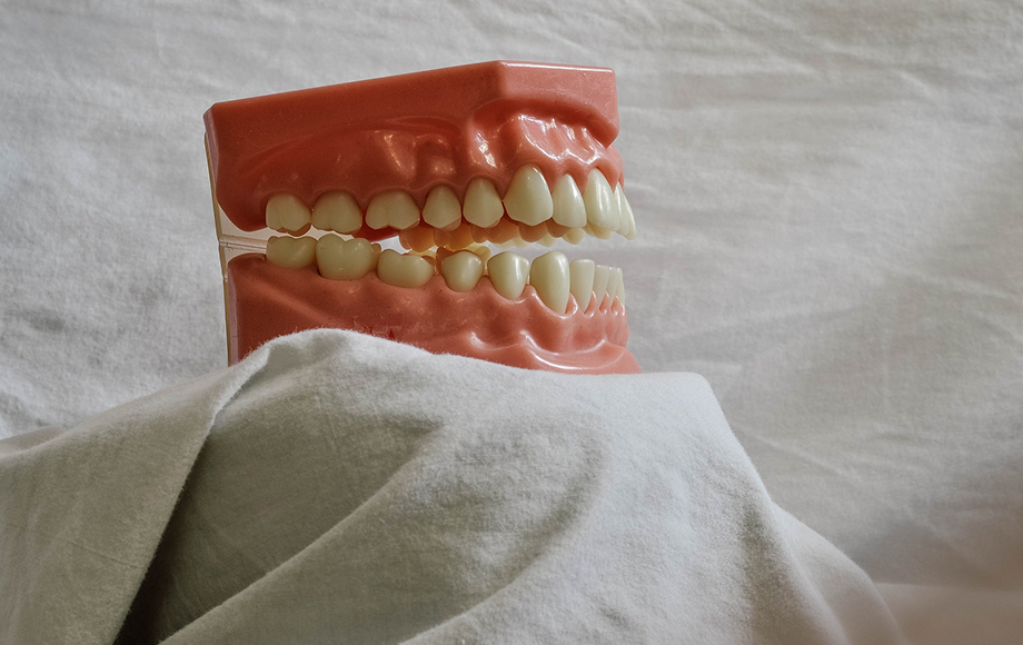 入れ歯のイメージ写真